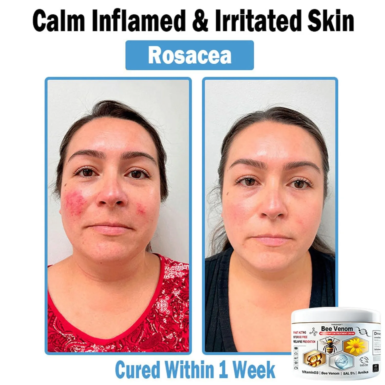 Bee Venom Multi Symptom Face Cream, Professional Bee Venom Cream, for All Skin Types (2 Bottle)