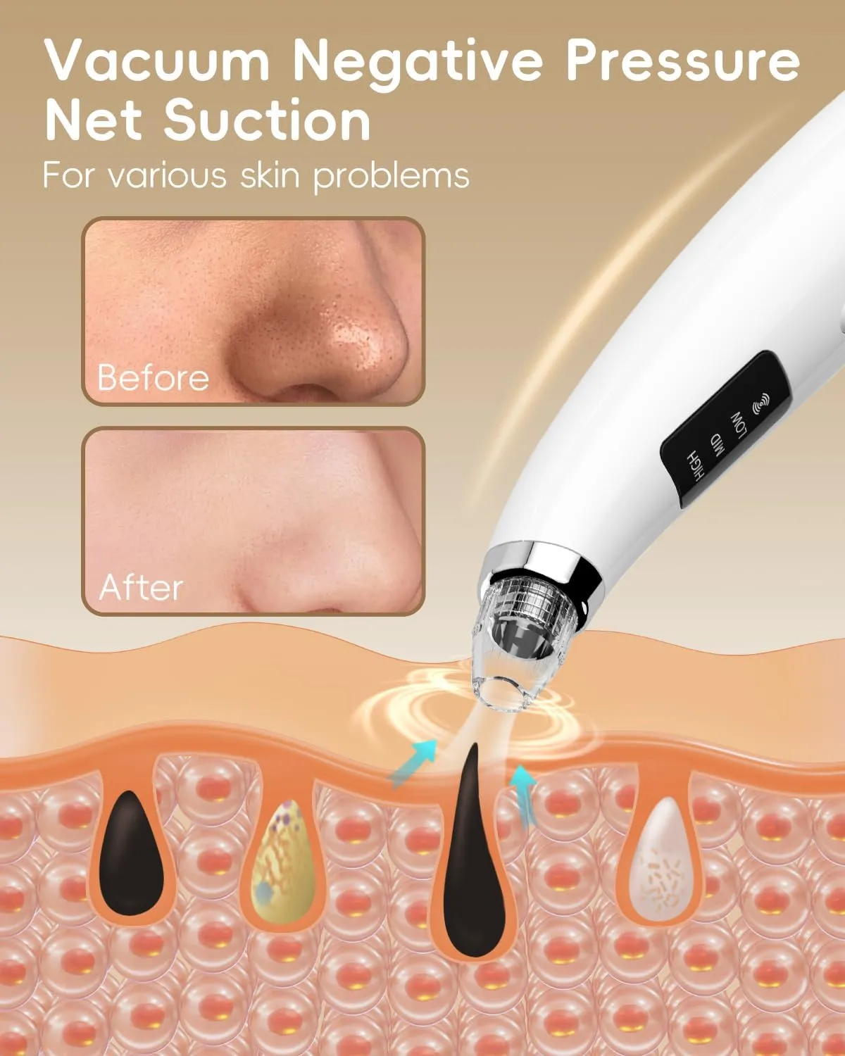 Facial Pore Blackhead Remover Vacuum - Face Cleaner and Blackhead Extractor with 3 Adjustable Suction Levels, 5 Probes, USB Charging Interface - Pore Vacuum Kit for Women&Men (White)
